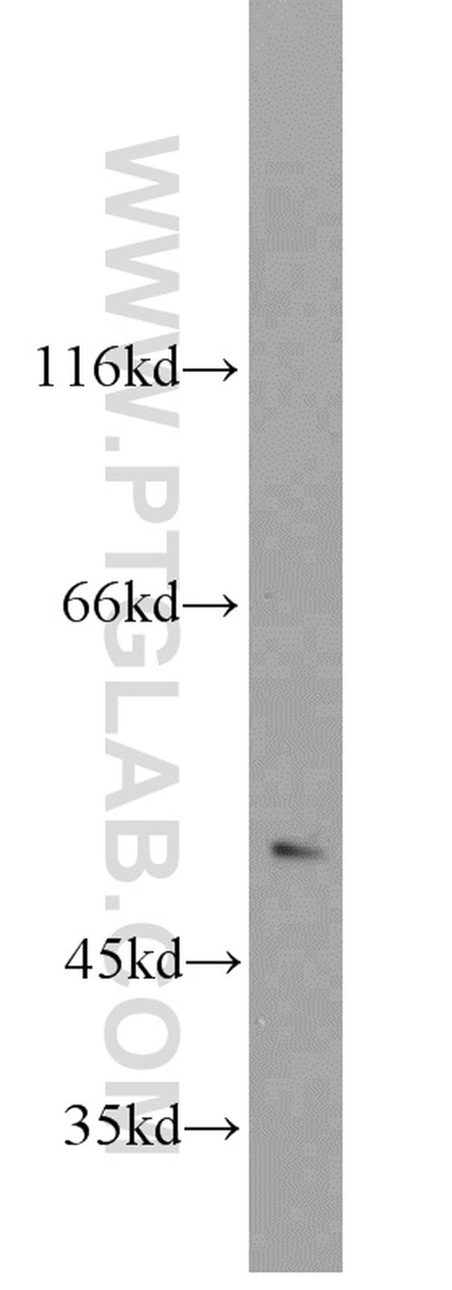 CHRNA3 Antibody in Western Blot (WB)