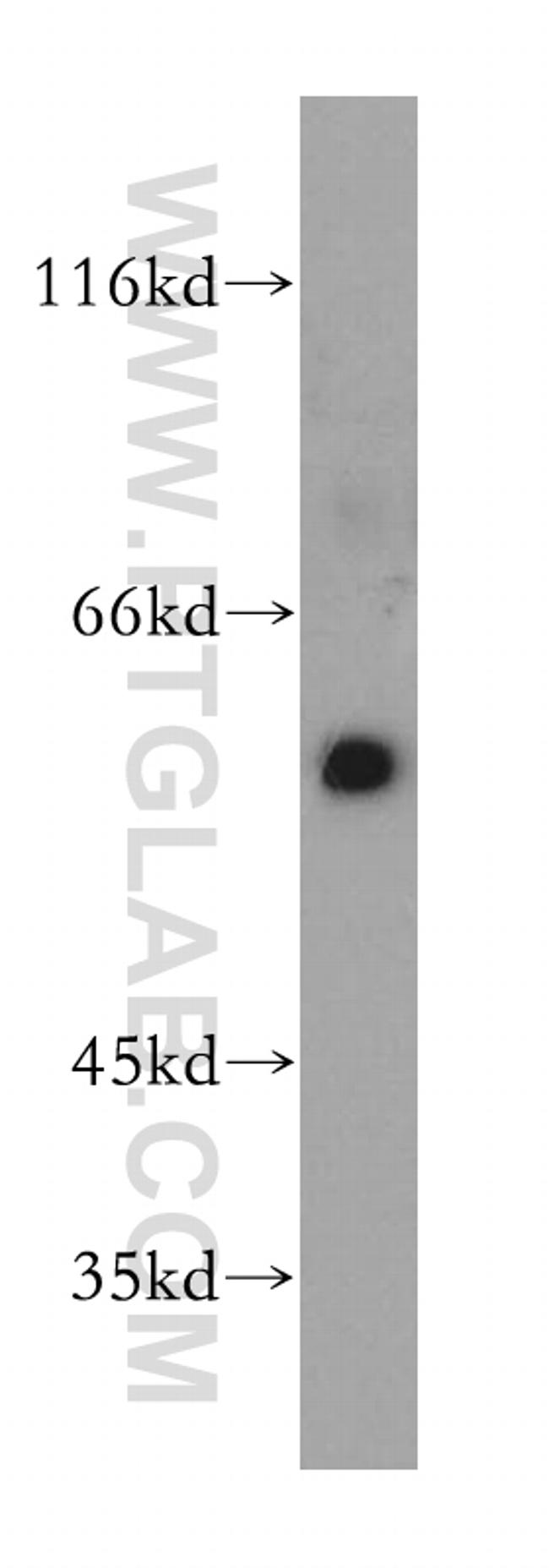 CHRNA3 Antibody in Western Blot (WB)