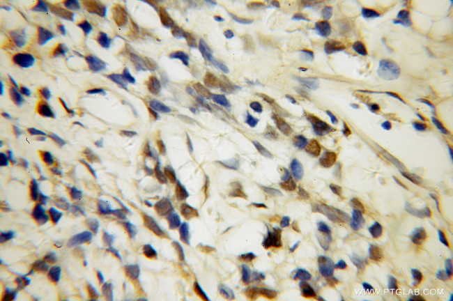 U2AF35 Antibody in Immunohistochemistry (Paraffin) (IHC (P))