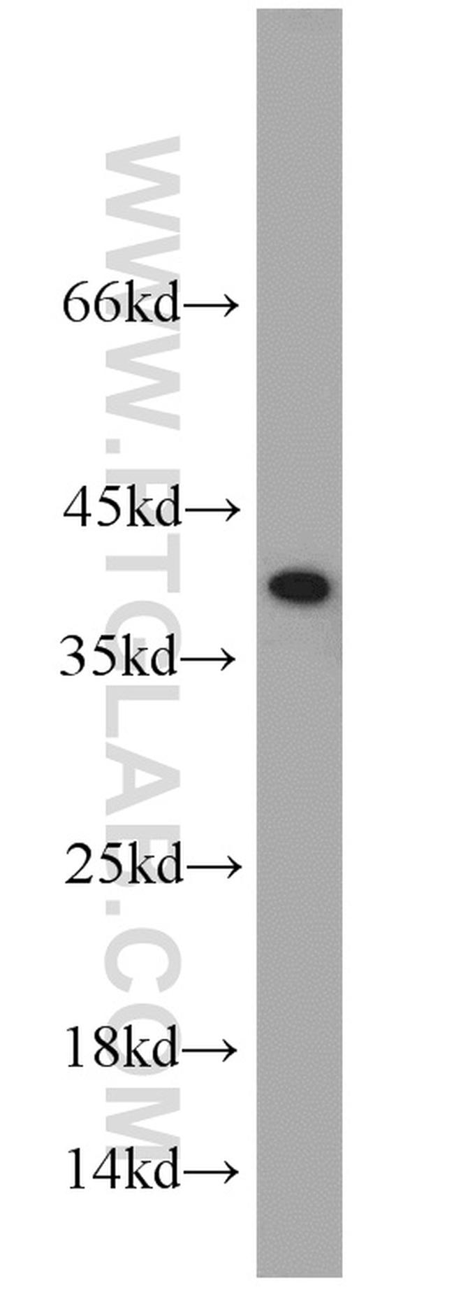 U2AF35 Antibody in Western Blot (WB)