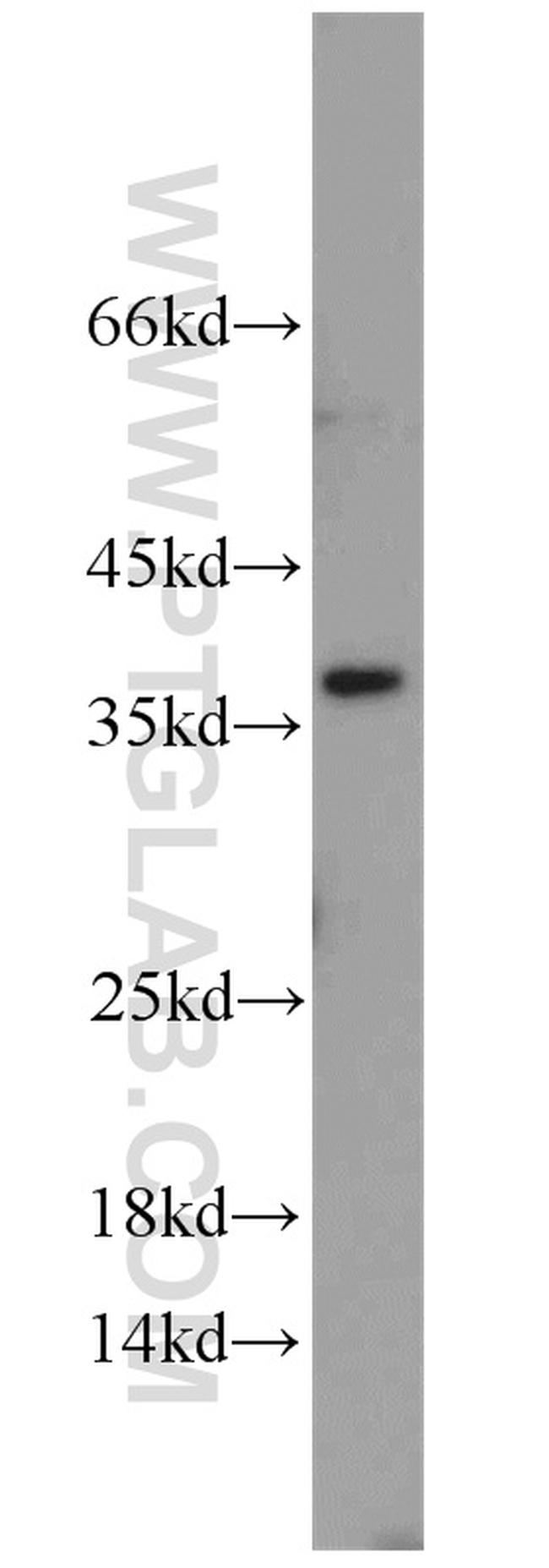 U2AF35 Antibody in Western Blot (WB)