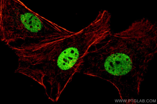 PAX8 Antibody in Immunocytochemistry (ICC/IF)