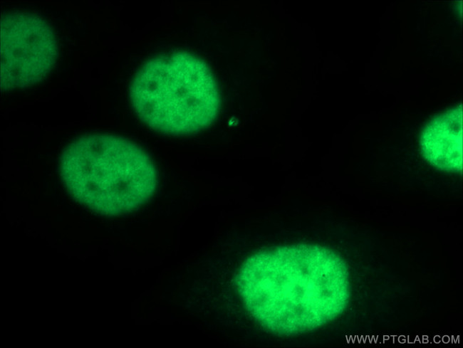 PAX8 Antibody in Immunocytochemistry (ICC/IF)