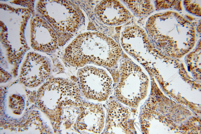 PAX8 Antibody in Immunohistochemistry (Paraffin) (IHC (P))