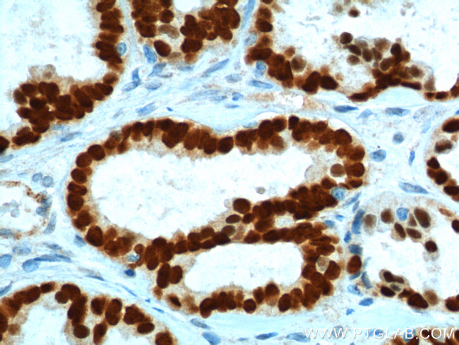 PAX8 Antibody in Immunohistochemistry (Paraffin) (IHC (P))