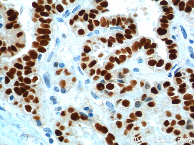 PAX8 Antibody in Immunohistochemistry (Paraffin) (IHC (P))