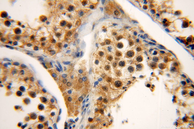 PAX8 Antibody in Immunohistochemistry (Paraffin) (IHC (P))