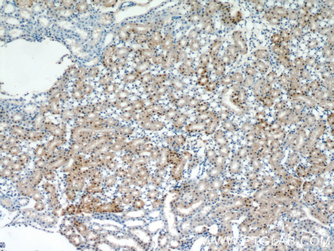 PAX8 Antibody in Immunohistochemistry (Paraffin) (IHC (P))