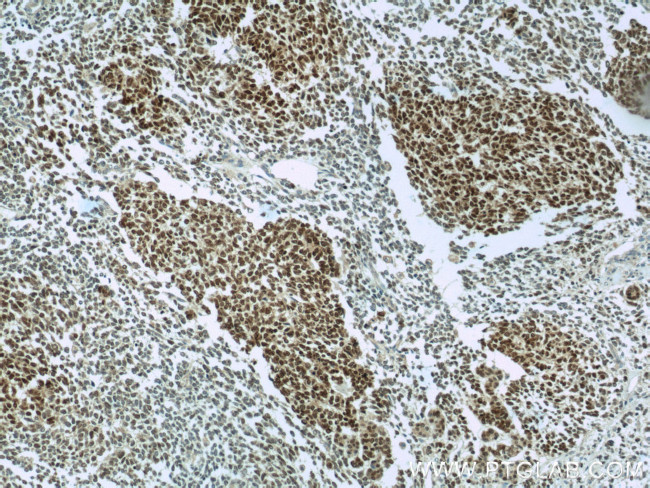 PAX8 Antibody in Immunohistochemistry (Paraffin) (IHC (P))