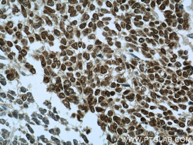 PAX8 Antibody in Immunohistochemistry (Paraffin) (IHC (P))