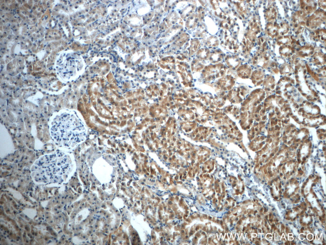 PAX8 Antibody in Immunohistochemistry (Paraffin) (IHC (P))