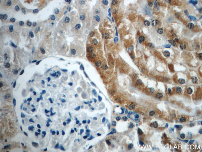 PAX8 Antibody in Immunohistochemistry (Paraffin) (IHC (P))