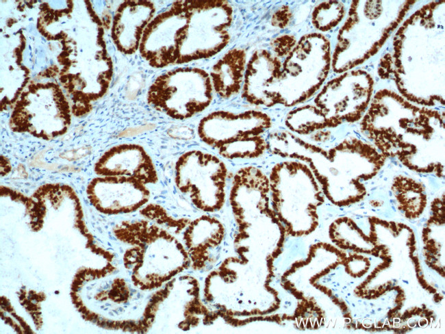 PAX8 Antibody in Immunohistochemistry (Paraffin) (IHC (P))