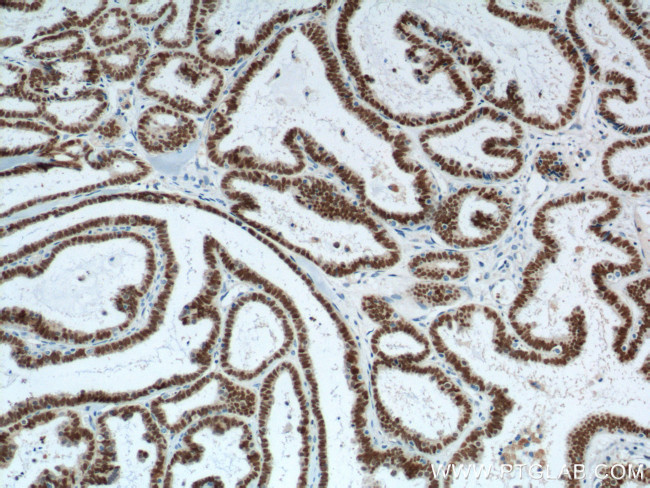 PAX8 Antibody in Immunohistochemistry (Paraffin) (IHC (P))