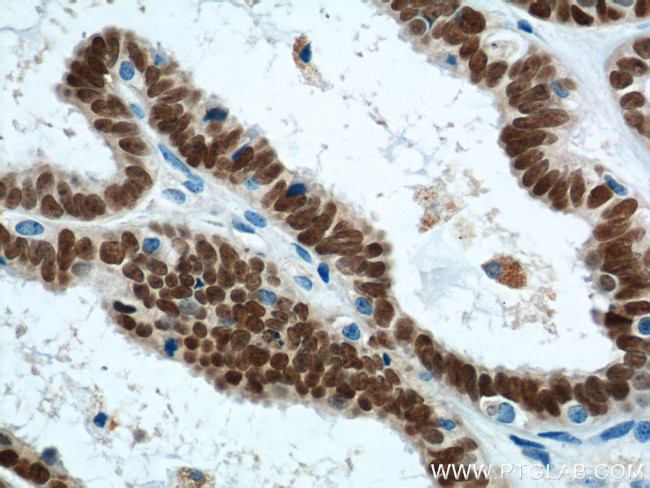 PAX8 Antibody in Immunohistochemistry (Paraffin) (IHC (P))