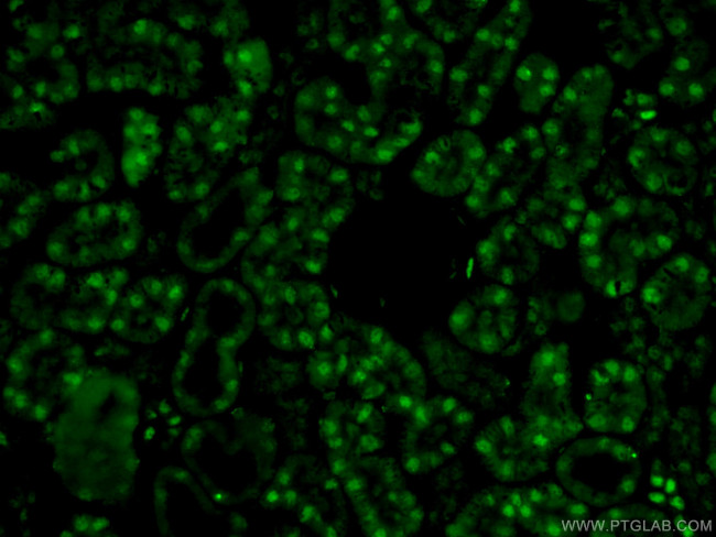 PAX8 Antibody in Immunohistochemistry (PFA fixed) (IHC (PFA))