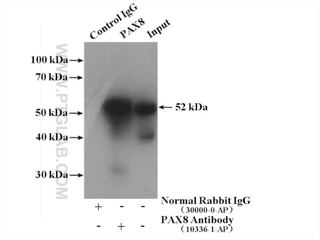 PAX8 Antibody in Immunoprecipitation (IP)