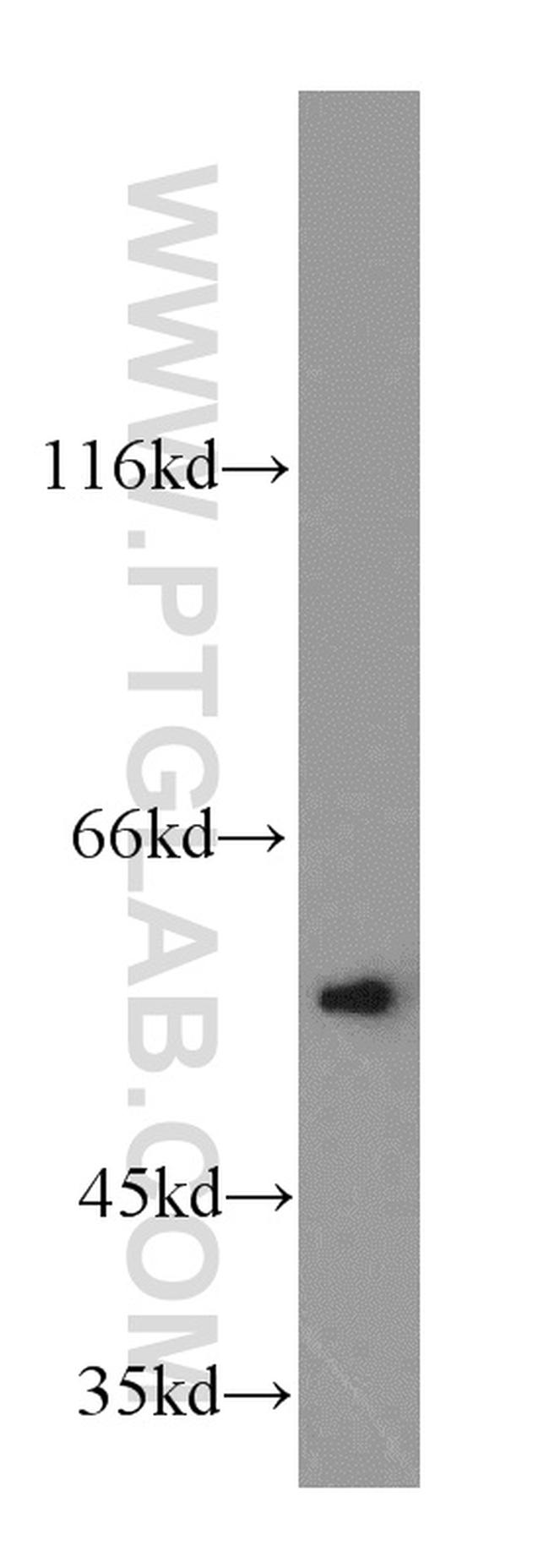 PAX8 Antibody in Western Blot (WB)