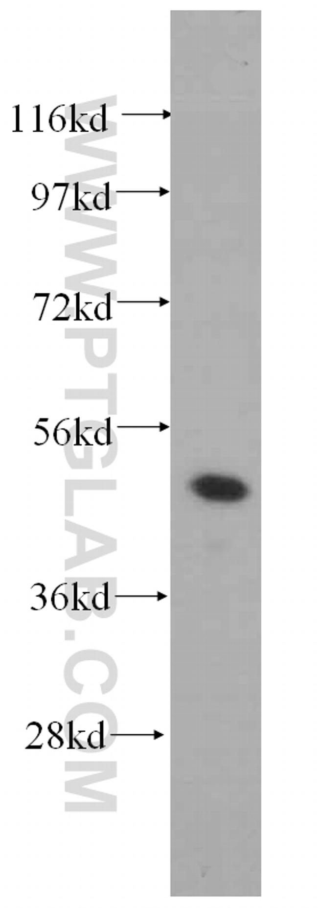 PAX8 Antibody in Western Blot (WB)