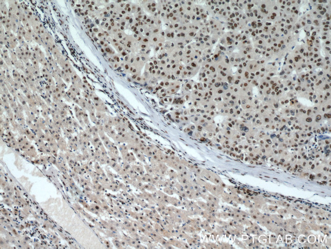 MAD2L1 Antibody in Immunohistochemistry (Paraffin) (IHC (P))