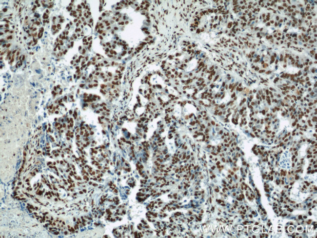 MAD2L1 Antibody in Immunohistochemistry (Paraffin) (IHC (P))