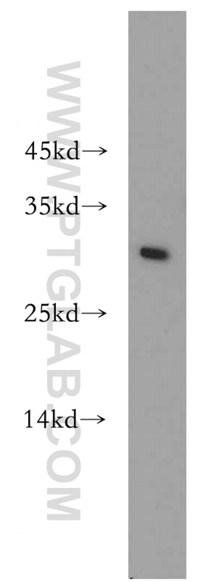 MAD2L1 Antibody in Western Blot (WB)