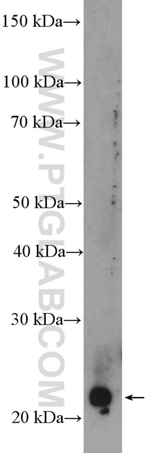 MAD2L1 Antibody in Western Blot (WB)