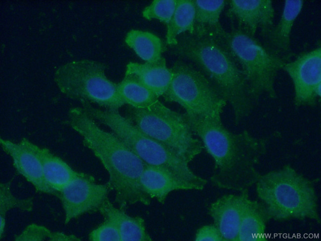 Melanophilin Antibody in Immunocytochemistry (ICC/IF)