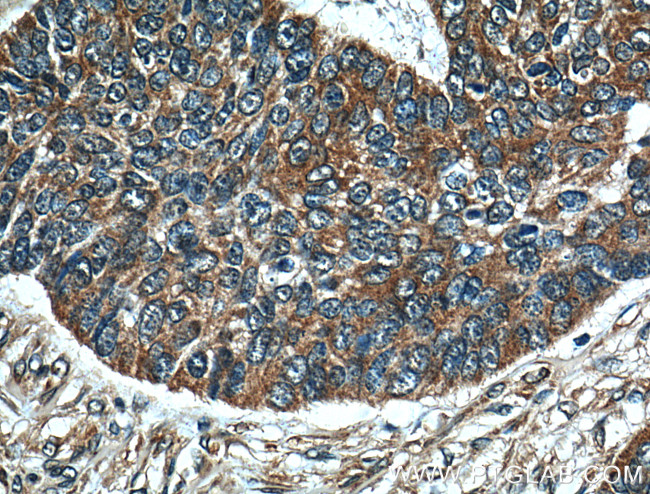 Melanophilin Antibody in Immunohistochemistry (Paraffin) (IHC (P))