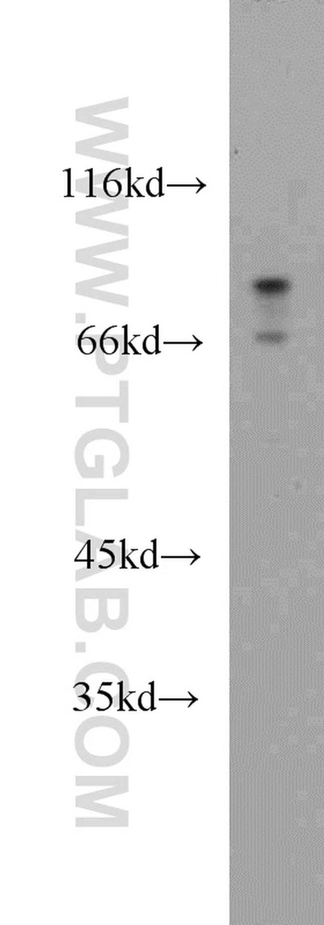 Melanophilin Antibody in Western Blot (WB)