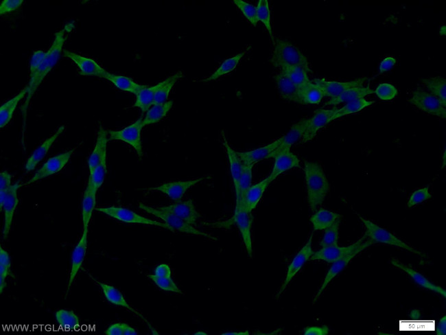 RAB6B Antibody in Immunocytochemistry (ICC/IF)