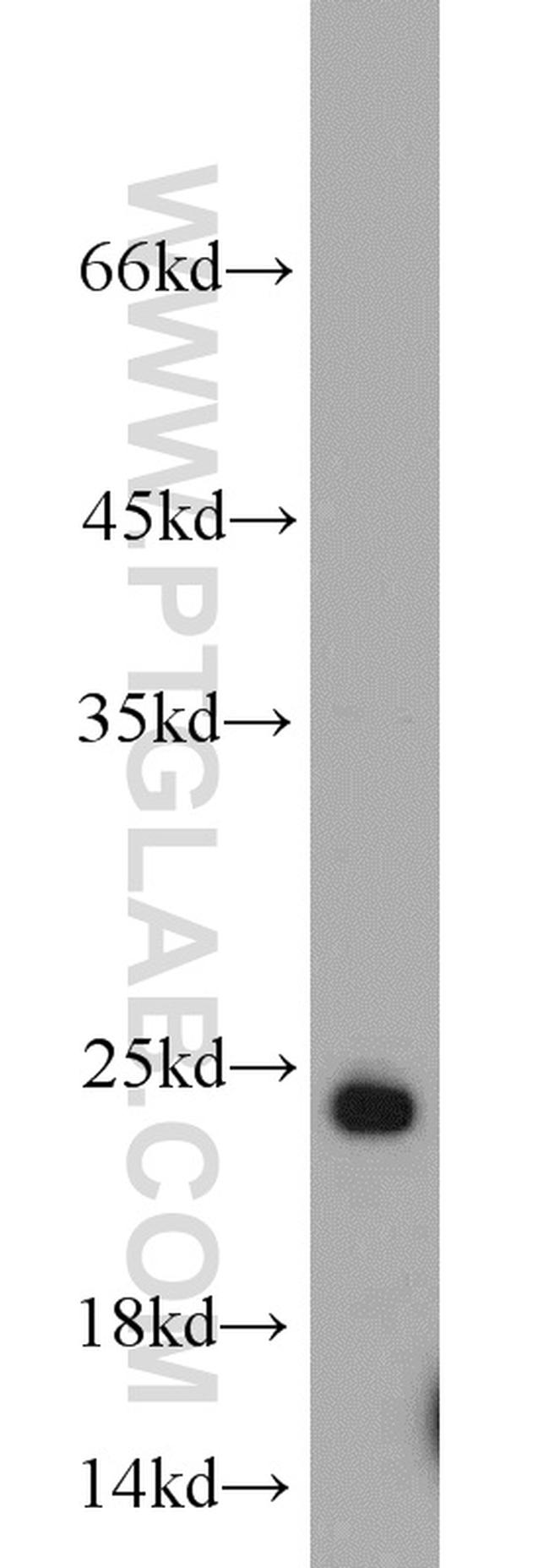 RAB6B Antibody in Western Blot (WB)