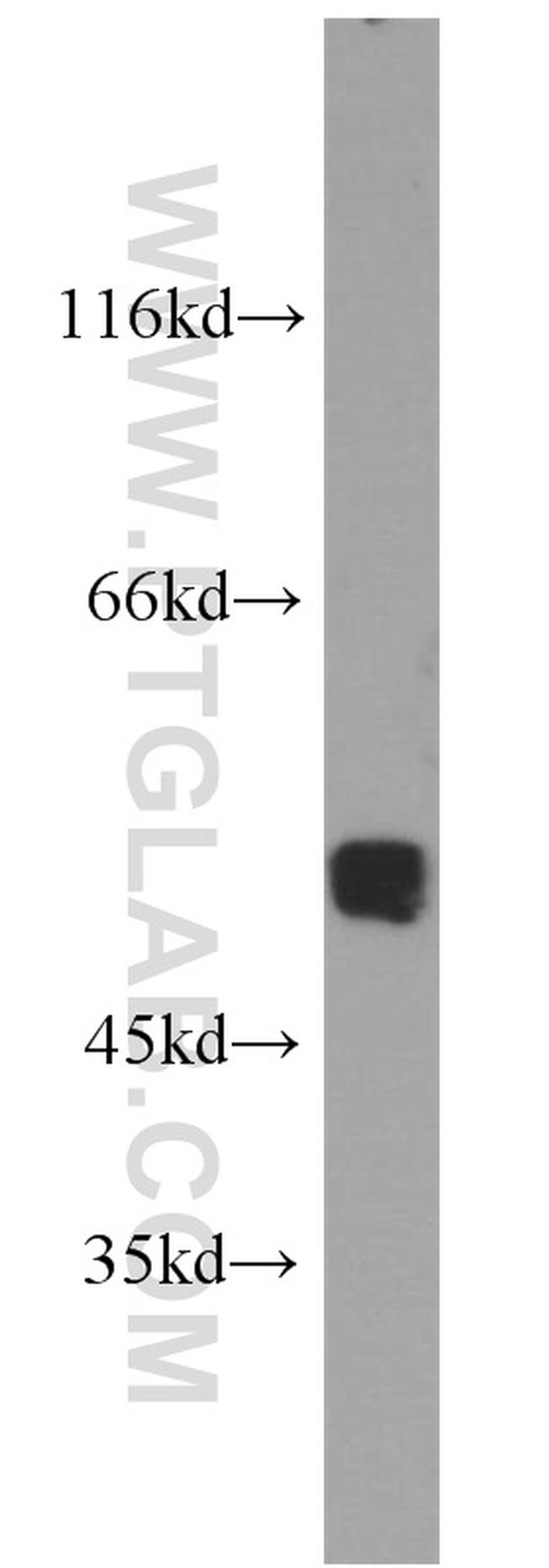 ACTL6A Antibody in Western Blot (WB)