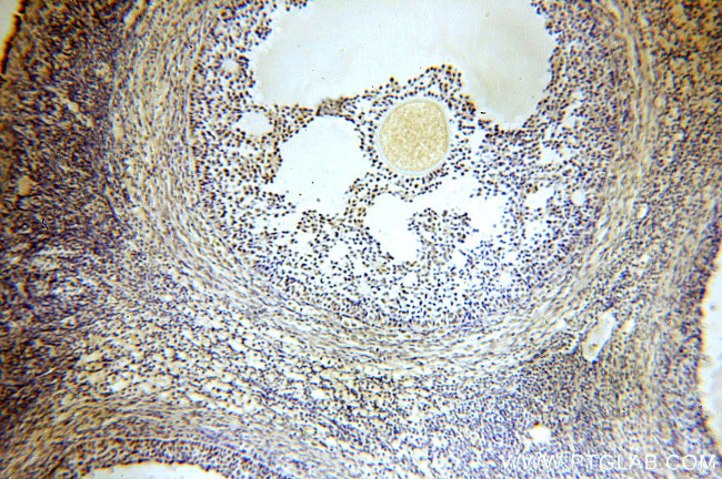 ACTL6A Antibody in Immunohistochemistry (Paraffin) (IHC (P))