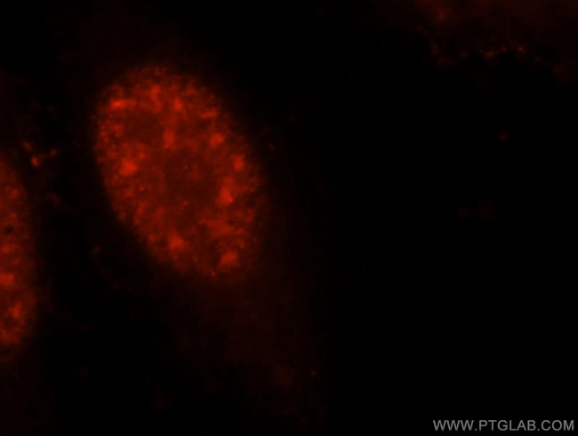 UBE3A Antibody in Immunocytochemistry (ICC/IF)