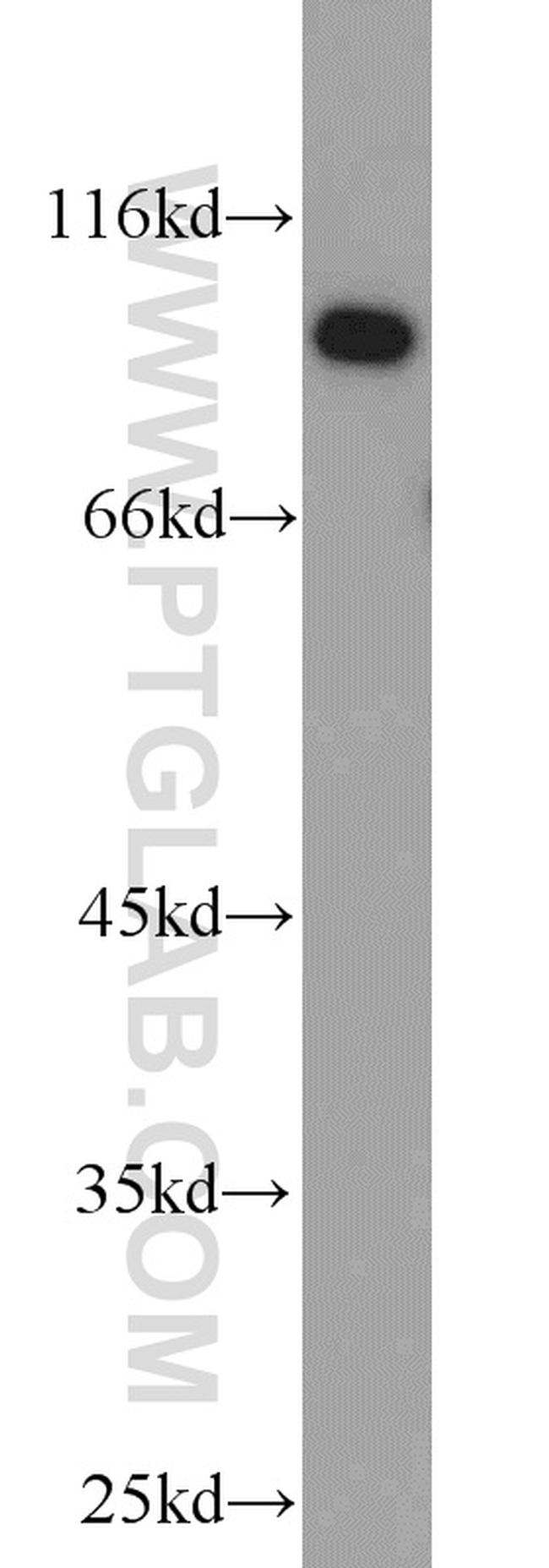 UBE3A Antibody in Western Blot (WB)