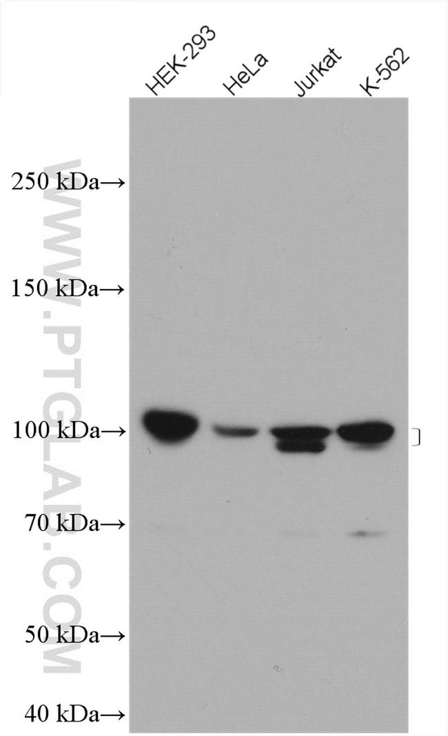 UBE3A Antibody in Western Blot (WB)