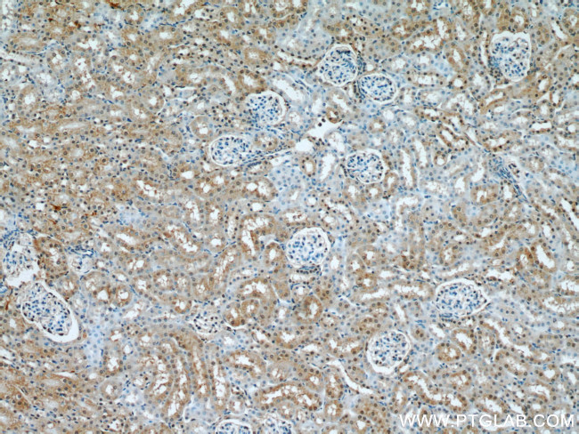 UBE3A Antibody in Immunohistochemistry (Paraffin) (IHC (P))