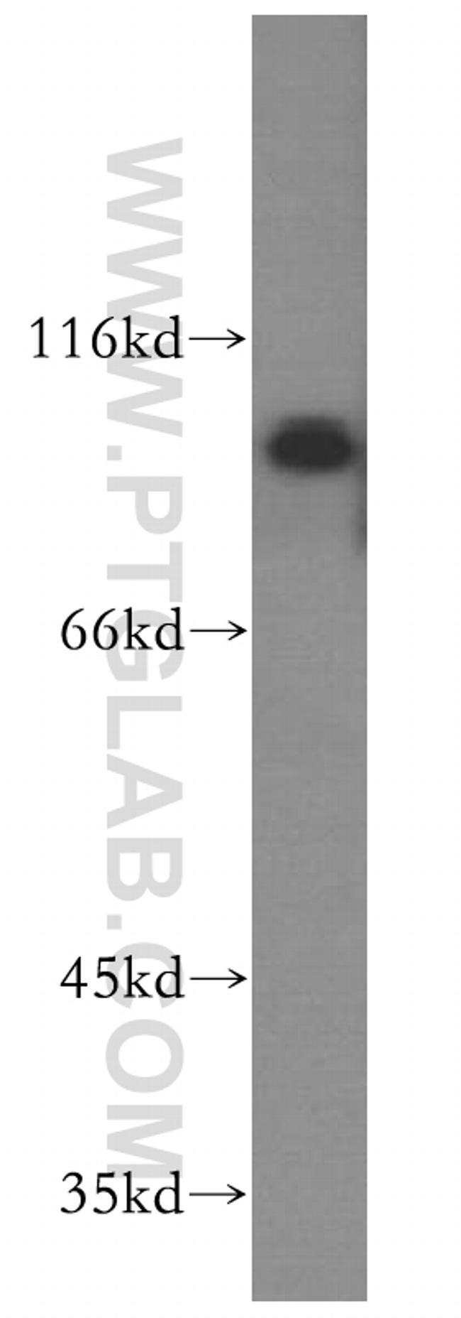 UBE3A Antibody in Western Blot (WB)