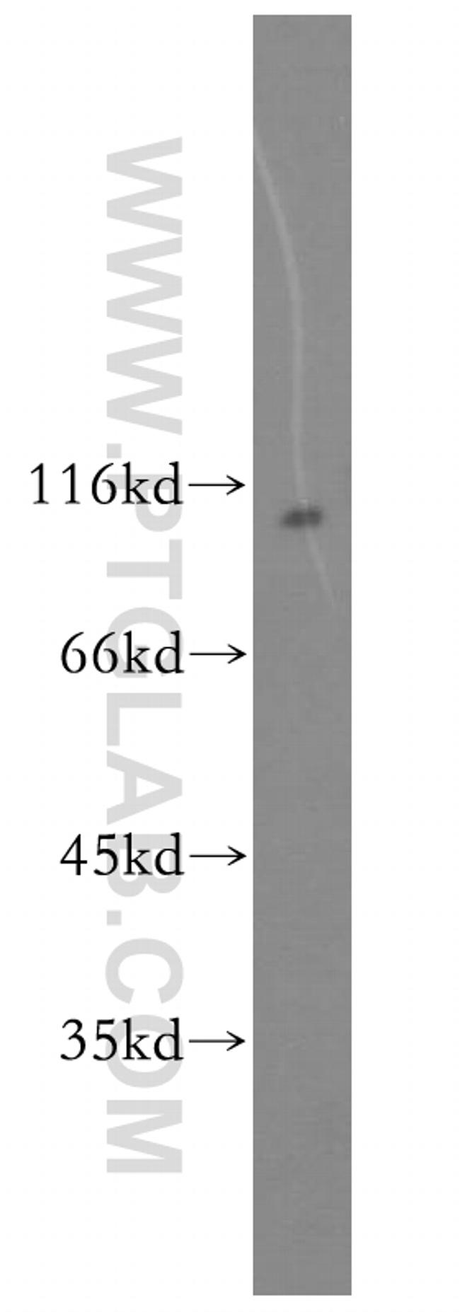 UBE3A Antibody in Western Blot (WB)