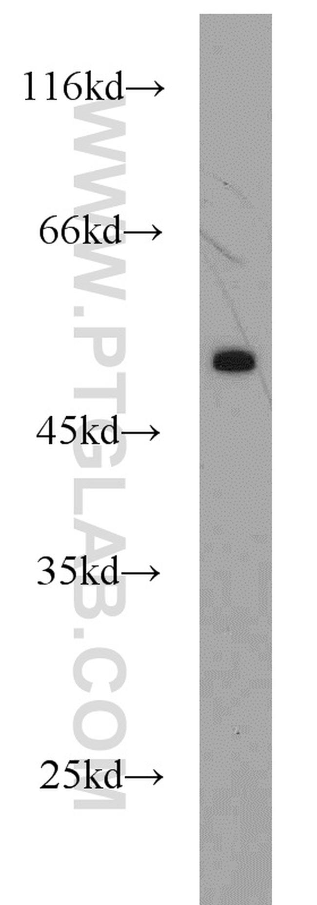 CTBP2 Antibody in Western Blot (WB)