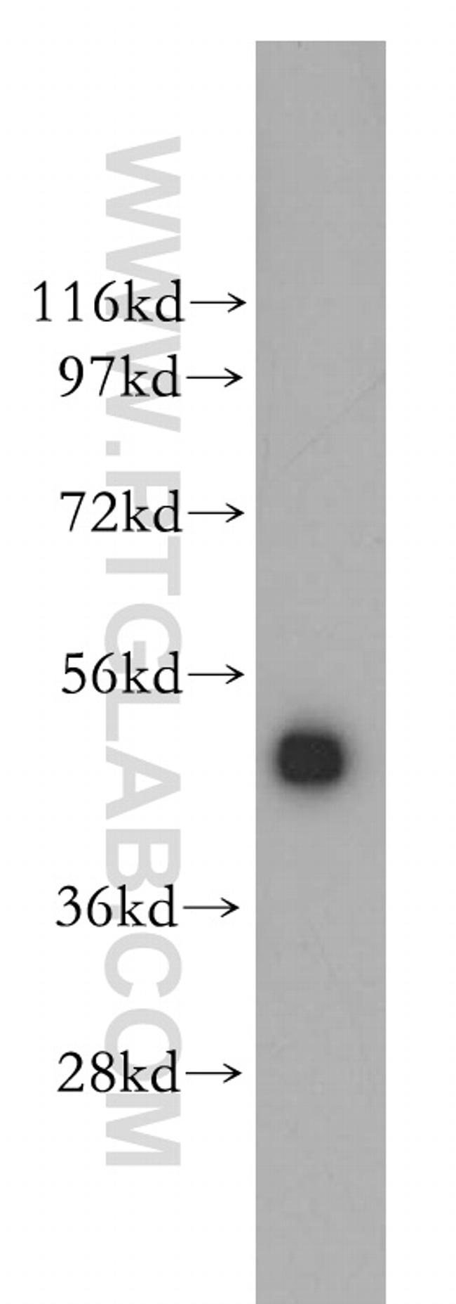 CTBP2 Antibody in Western Blot (WB)