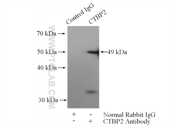 CTBP2 Antibody in Immunoprecipitation (IP)