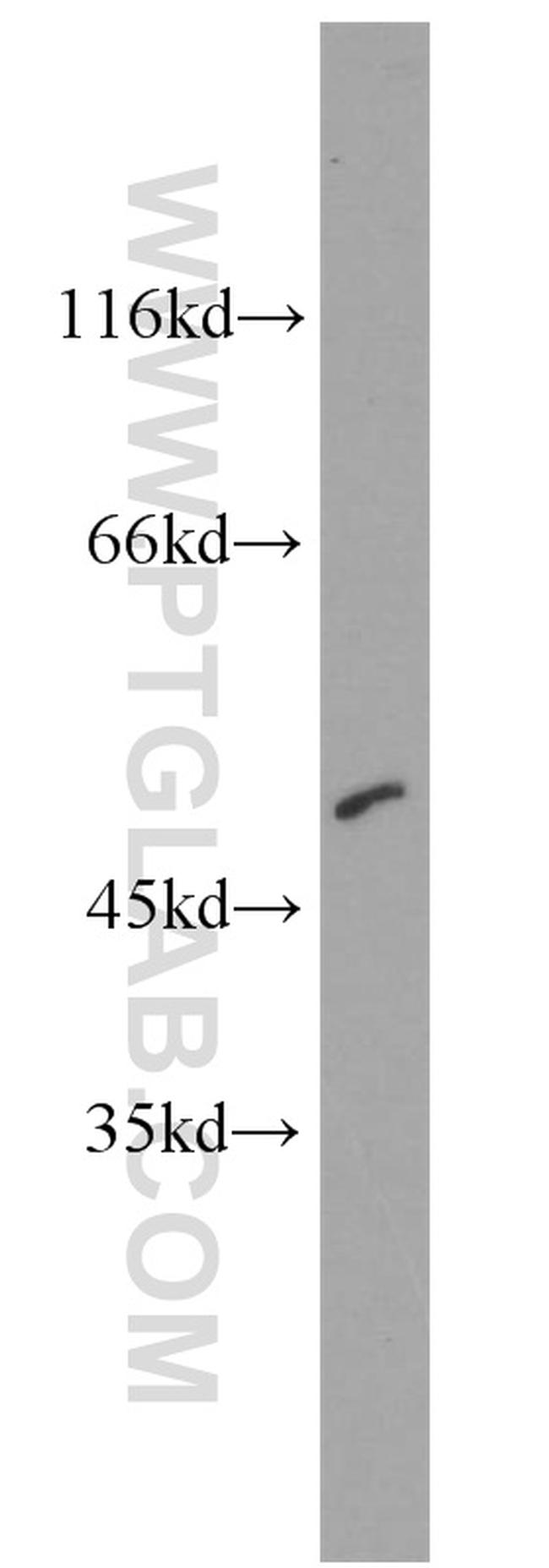 CTBP2 Antibody in Western Blot (WB)