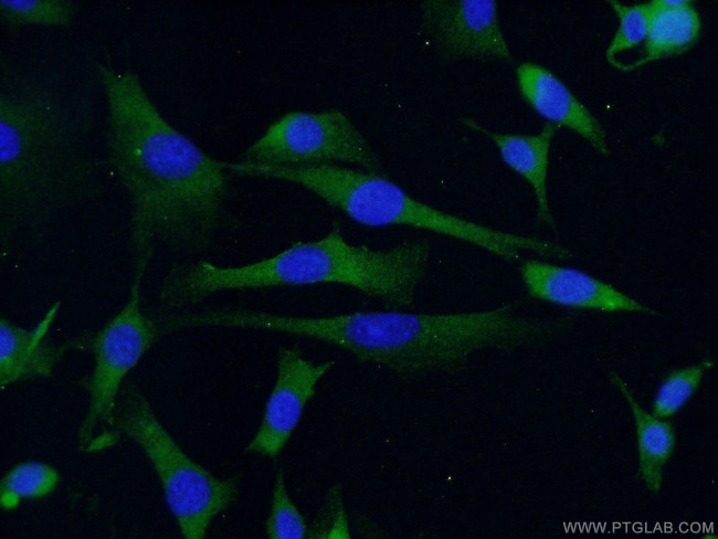 RAB4A Antibody in Immunocytochemistry (ICC/IF)