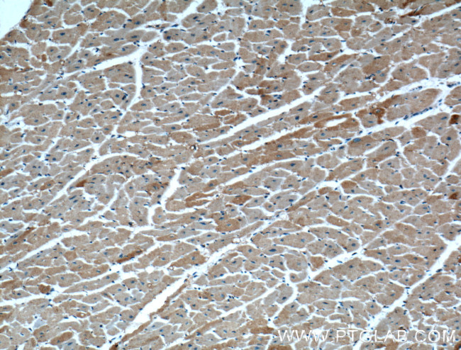 RAB4A Antibody in Immunohistochemistry (Paraffin) (IHC (P))