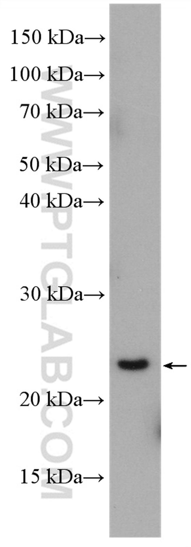 RAB4A Antibody in Western Blot (WB)