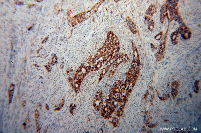 STOML2 Antibody in Immunohistochemistry (Paraffin) (IHC (P))