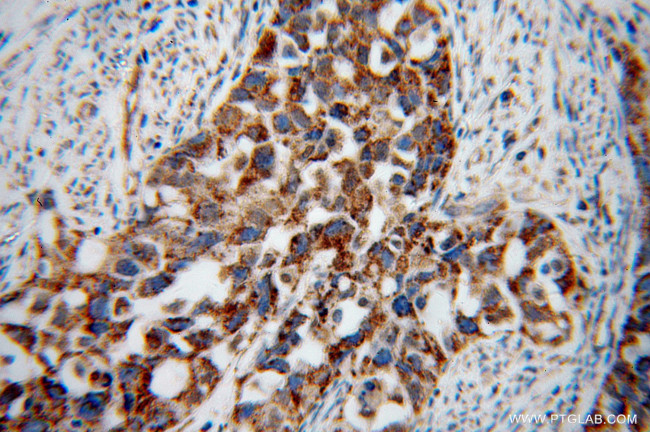 STOML2 Antibody in Immunohistochemistry (Paraffin) (IHC (P))