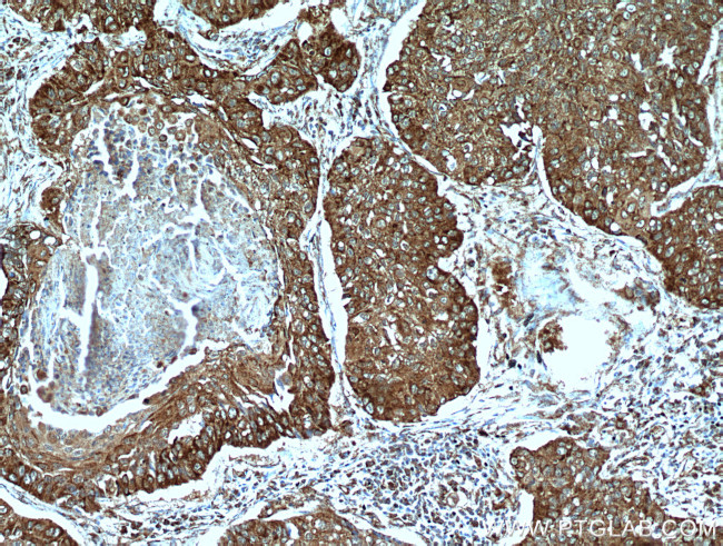 STOML2 Antibody in Immunohistochemistry (Paraffin) (IHC (P))